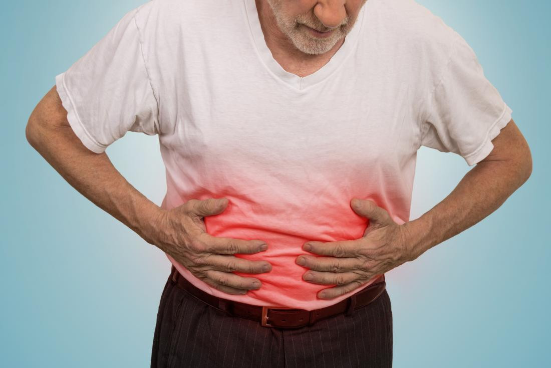 Volvulus